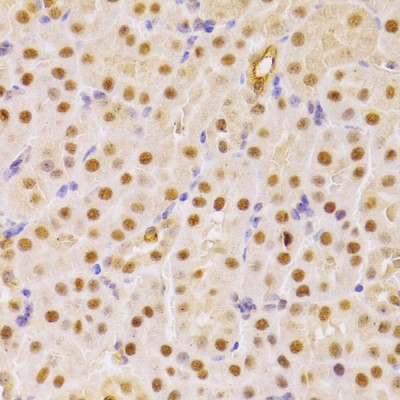 CDC25A Rabbit pAb (20 μl)