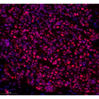Anti-PCNA Rabbit pAb (100 μl)