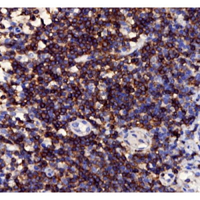 Anti-CD3 Rabbit pAb (100 μl)