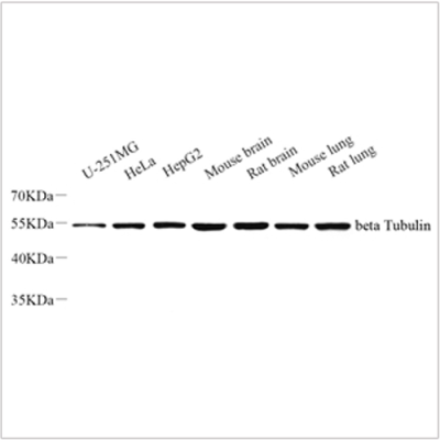 Anti-beta Tubulin Rabbit pAb (100 μl)