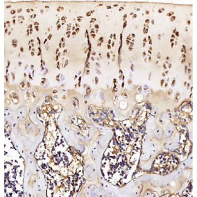 Anti-Collagen II Rabbit pAb (100 μl)
