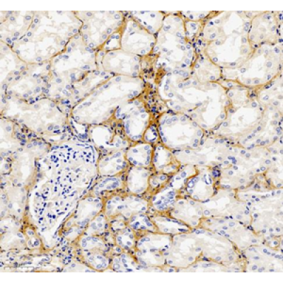 Anti-Collagen I Rabbit pAb (100 μl)