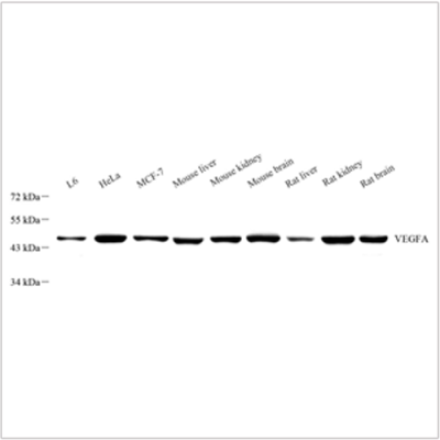 Anti-VEGFA Rabbit pAb (100 μl)