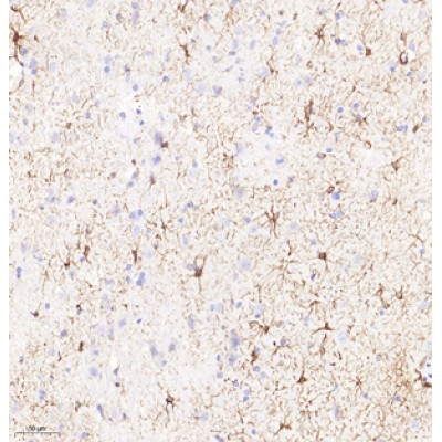 Anti-GFAP Rabbit pAb (100 μl)