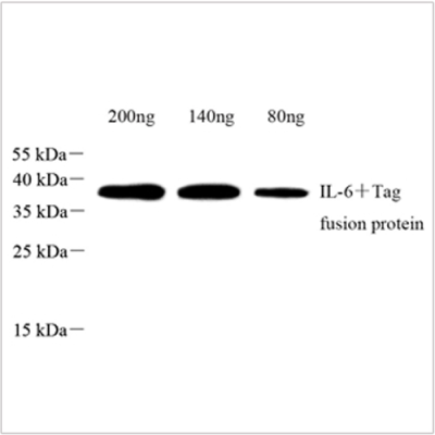 Anti-IL-6 Rabbit pAb (100 μl)