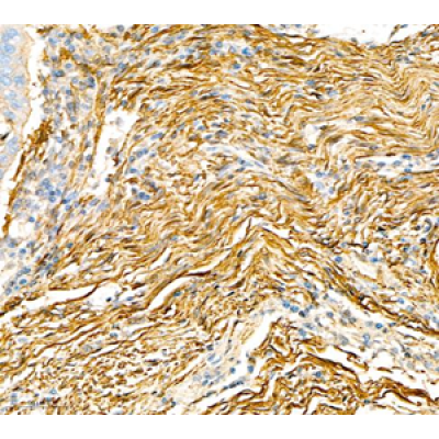 Anti-alpha smooth muscle Actin Rabbit pAb (100 μl)
