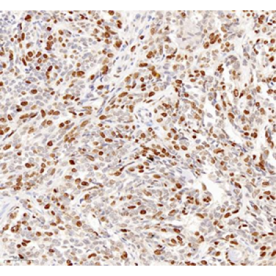 Anti-Ki67 Rabbit pAb (100 μl)