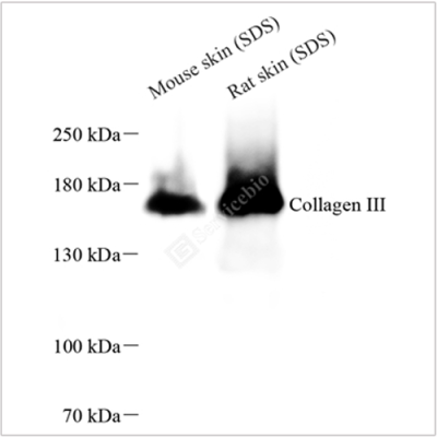 Anti-Collagen III Rabbit pAb (100 μl)