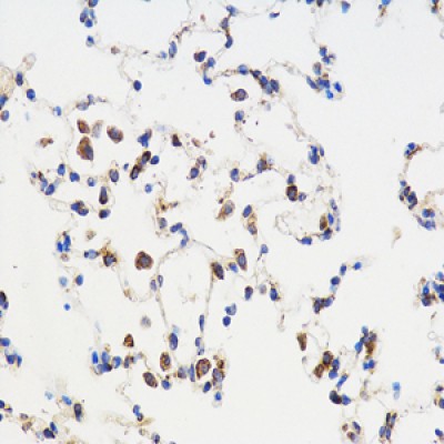 Anti-TGF beta 1 Rabbit pAb (100 μl)