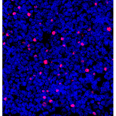 Anti-FOXP3 Rabbit pAb (100 μl)