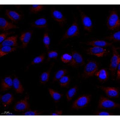 Anti-SQSTM1/p62 Rabbit pAb (100 μl)