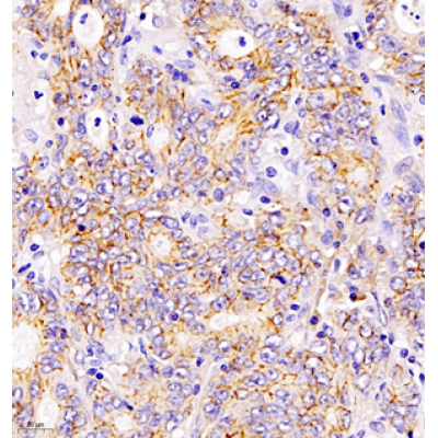 Anti-Claudin 1 Rabbit pAb (100 μl)