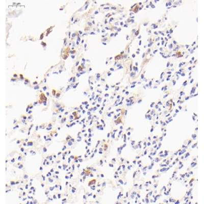 Anti-MRC1 Rabbit pAb (100 μl)