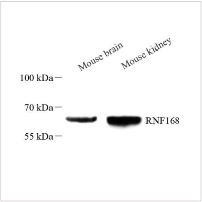 Anti-Rnf168 Rabbit pAb (100 μl)
