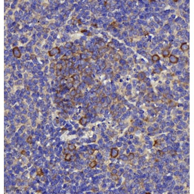 Anti-TLR4 Rabbit pAb (100 μl)