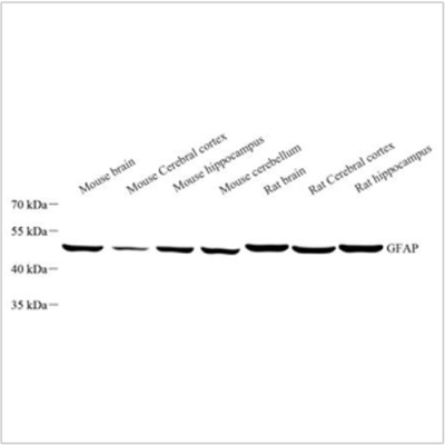 Anti-GFAP Mouse mAb (100 μl)