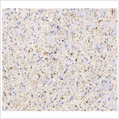 Anti-Iba1 Mouse mAb (100 μl)