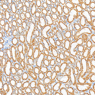 Anti-VDAC1/Porin Mouse mAb (100 μl)