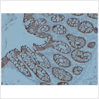 Anti-Villin Mouse mAb (50 μl)