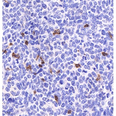 Recombinant Anti-CD4 Rabbit mAb (100 μl)