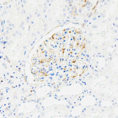 Recombinant Anti-VEGFA Rabbit mAb (100 μl)