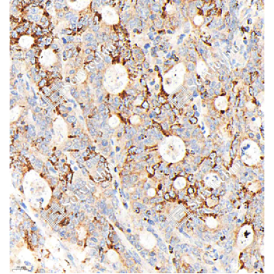 Recombinant Anti-Bax Rabbit mAb (100 μl)